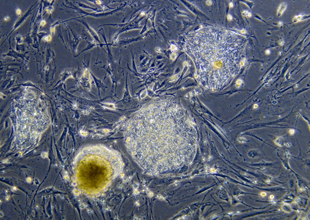 A colony of undifferentiated embryonic stem cells. (University of Wisconsin-Madison)