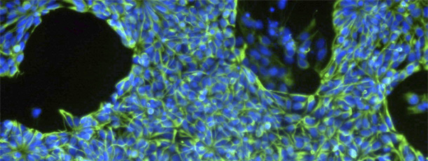 Microscopic view of neural precursor cells derived from human embryonic stem cells. (Gabriela Cezar lab, University of Wiscsonsin-Madison)