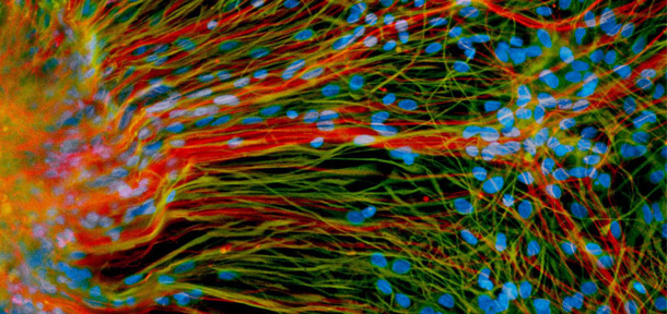 Derived from human embryonic stem cells, precursor neural cells grow in a lab dish and generate mature neurons (red) and glial cells (green), in the lab of University of Wisconsin-Madison stem cell researcher and neurodevelopmental biologist Su-Chun Zhang. (University of Wisconsin Stem Cell and Regenerative Medicine Center)