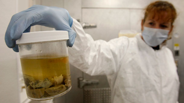 Institute for Marine Mammal Studies veterinary technician Wendy Hatchett holds up a jar containing organ samples from dead dolphins found along the Gulf Coast in Gulfport, Mississippi. (AP/Patrick Semansky)