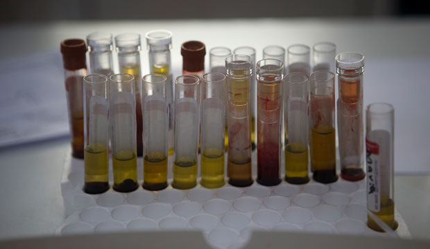 Blood samples from pregnant women wait to be analyzed for the Zika virus at a hospital in Guatemala City on February 2, 2016. (AP/Moises Castillo)