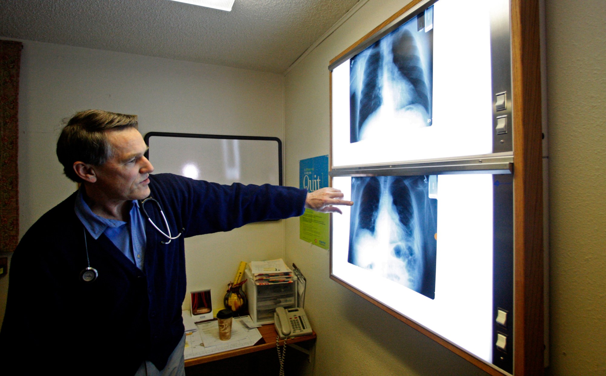Dr. Brad Black, director of an asbestos clinic in Montana, looks at X-rays, June 18, 2010. (AP/Rick Bowmer)