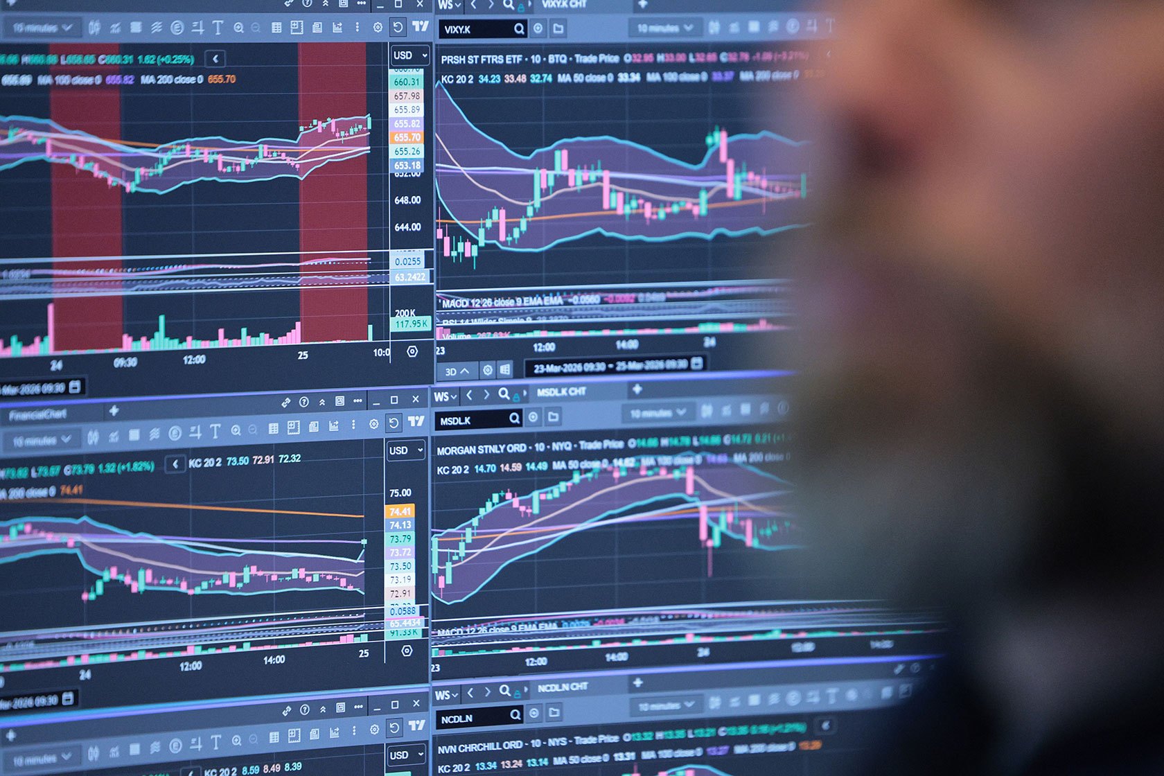 Blurred silhouette of a person's head in front of a monitor filled with stock charts, moving averages, and price data in green and pink.